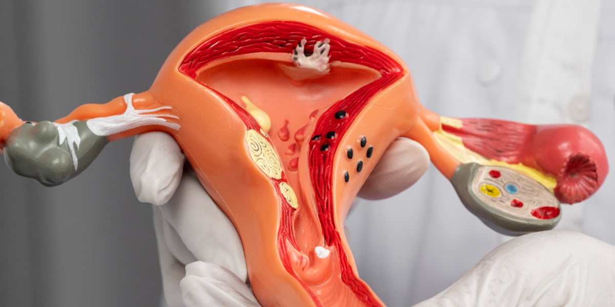 Kesehatan Reproduksi